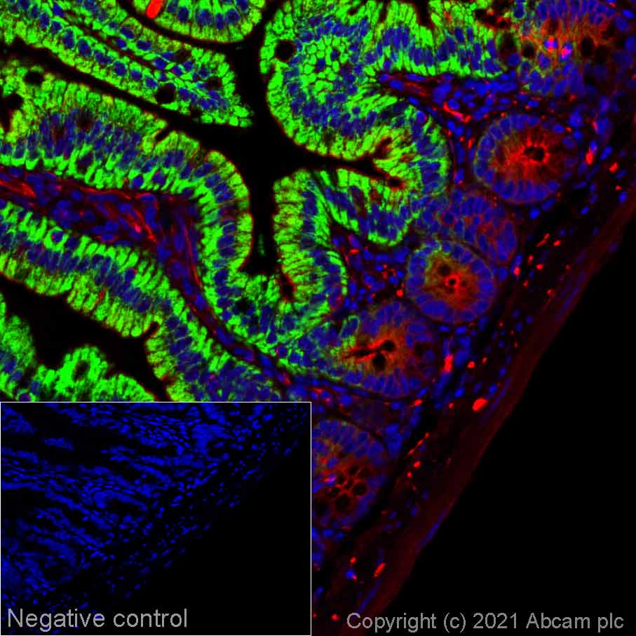 Immunohistochemistry (Formalin/PFA-fixed paraffin-embedded sections) - Alexa Fluor® 555 Anti-Arg2 antibody [EPR22626-38] (AB283492), expandable thumbnail