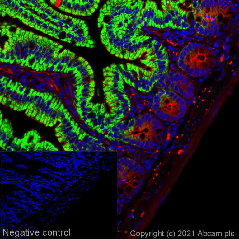 Immunohistochemistry (Formalin/PFA-fixed paraffin-embedded sections) - Alexa Fluor® 555 Anti-Arg2 antibody [EPR22626-38] (AB283492)