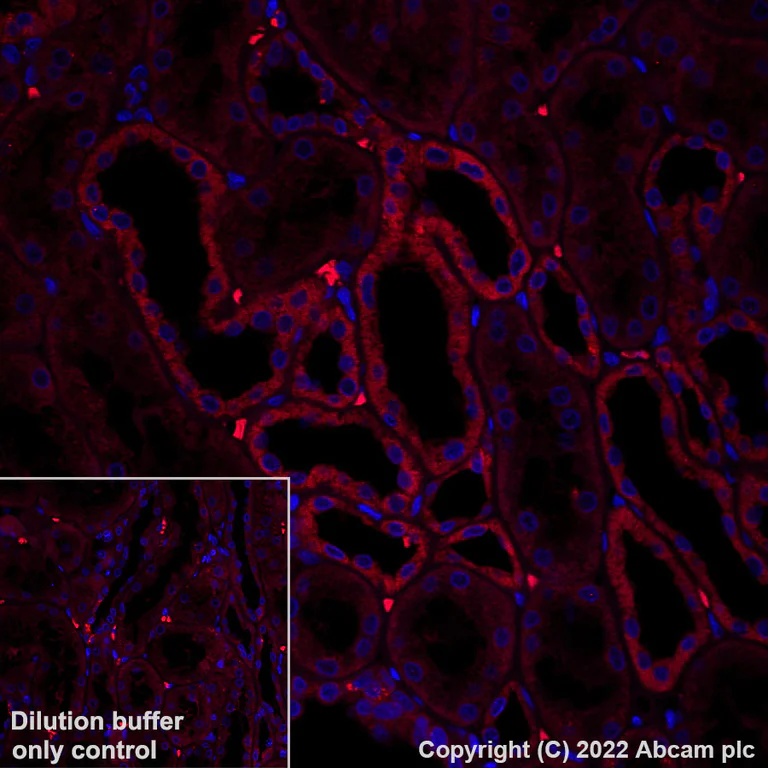 Immunohistochemistry (Formalin/PFA-fixed paraffin-embedded sections) - Alexa Fluor® 555 Anti-Bcl-XL antibody [E18] (AB306571)