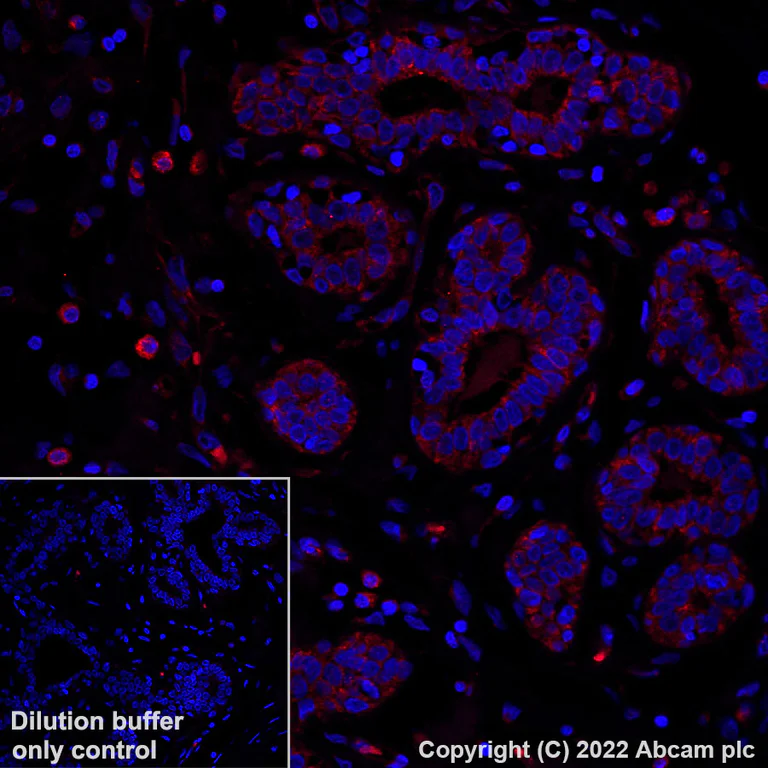 Immunohistochemistry (Formalin/PFA-fixed paraffin-embedded sections) - Alexa Fluor® 555 Anti-Bcl-XL antibody [E18] (AB306571)