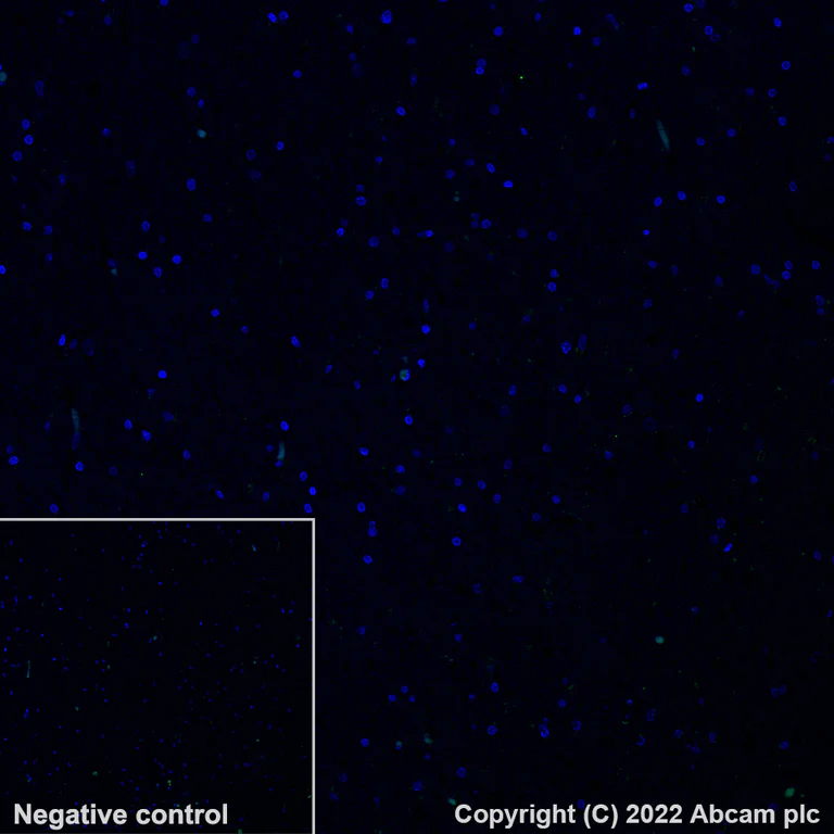 Immunohistochemistry - Alexa Fluor® 555 Anti-beta Amyloid 1-42 antibody [mOC64] (AB302544)