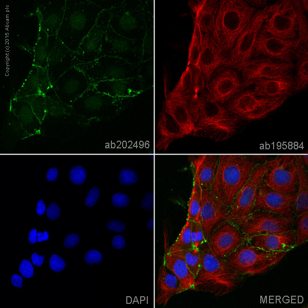 Immunocytochemistry/ Immunofluorescence - Alexa Fluor® 555 Anti-beta Catenin antibody [E247] (AB202496), expandable thumbnail