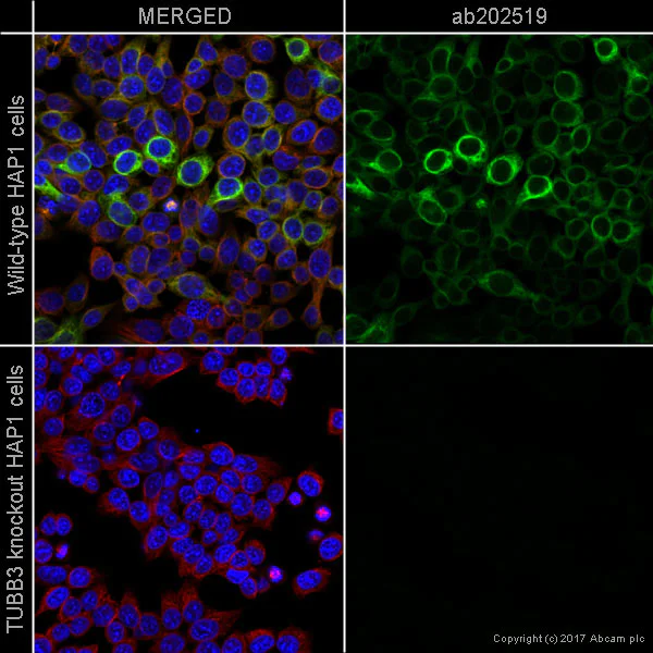 Immunocytochemistry/ Immunofluorescence - Alexa Fluor® 555 Anti-beta III Tubulin antibody [EP1569Y] - Neuronal Marker (AB202519)