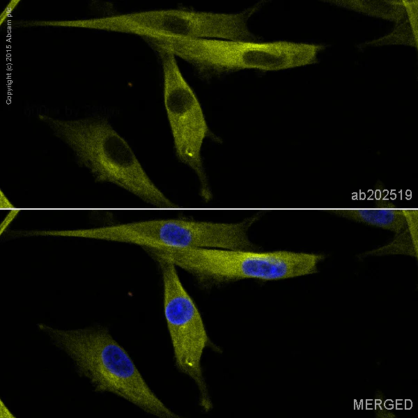 Immunocytochemistry/ Immunofluorescence - Alexa Fluor® 555 Anti-beta III Tubulin antibody [EP1569Y] - Neuronal Marker (AB202519)