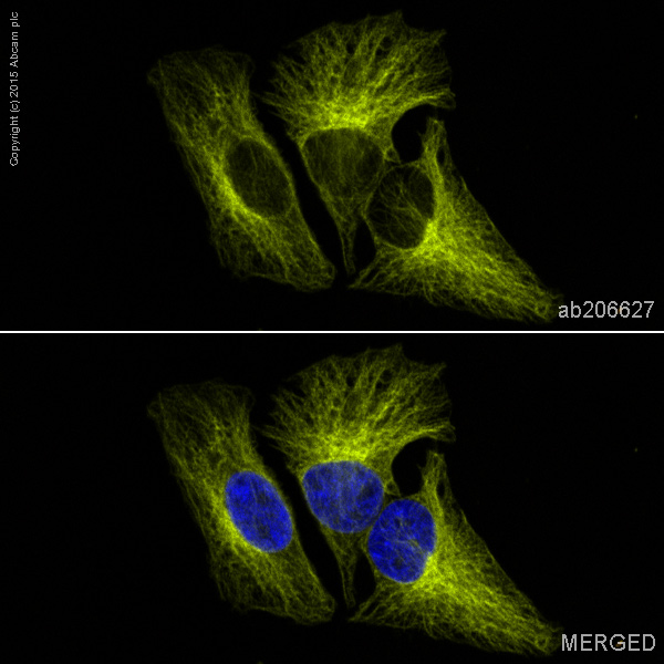 Immunocytochemistry/ Immunofluorescence - Alexa Fluor® 555 Anti-beta Tubulin antibody [EPR16774] - Microtubule Marker (AB206627), expandable thumbnail