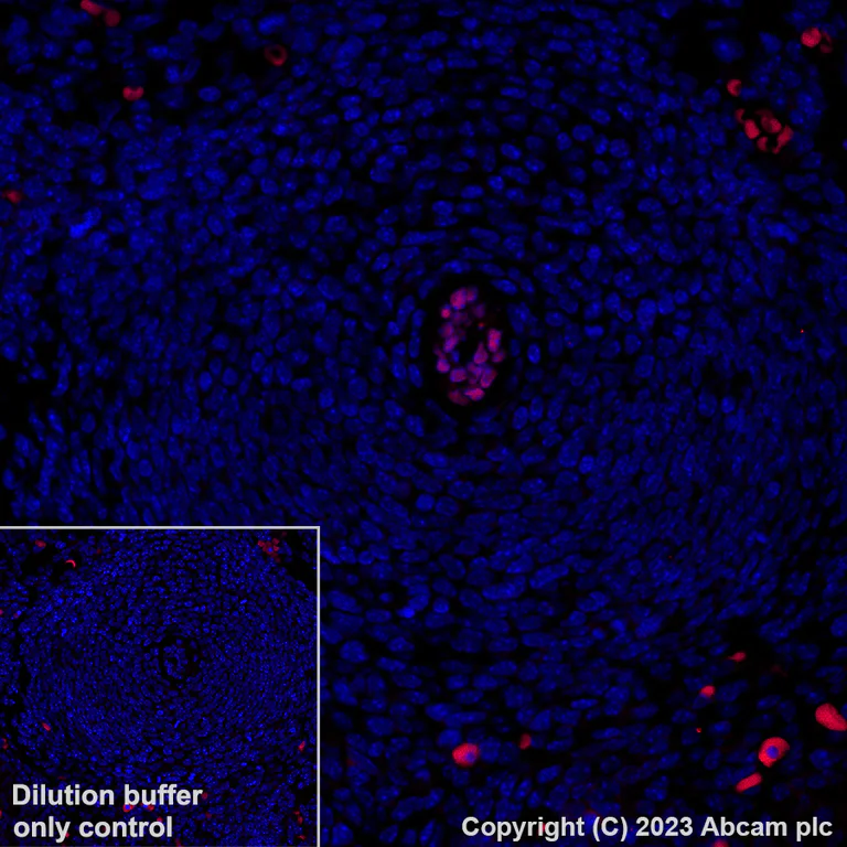 Immunohistochemistry (Formalin/PFA-fixed paraffin-embedded sections) - Alexa Fluor® 555 Anti-Brachyury / Bry antibody [EPR18113] (AB314675)