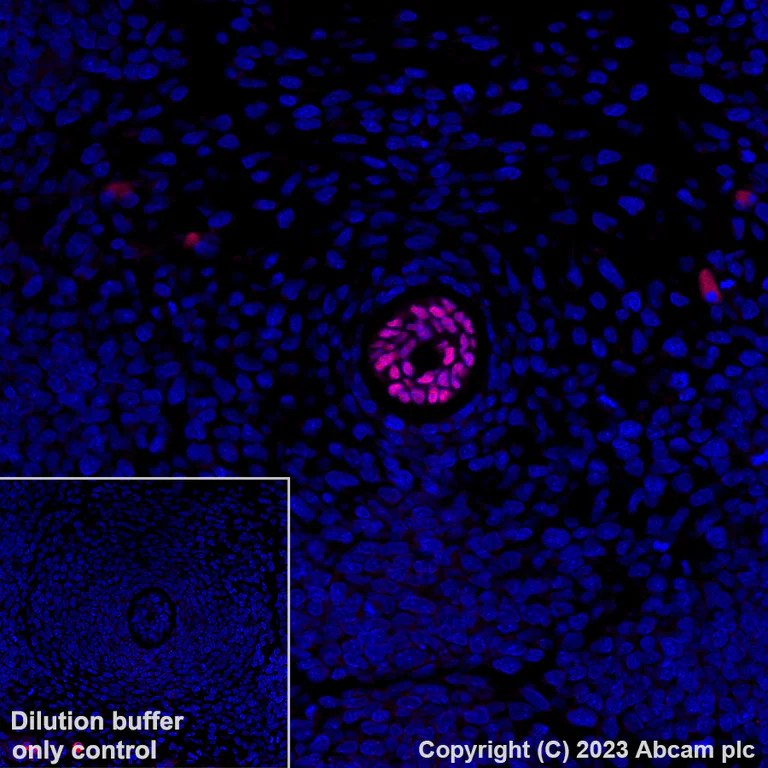 Immunohistochemistry (Formalin/PFA-fixed paraffin-embedded sections) - Alexa Fluor® 555 Anti-Brachyury / Bry antibody [EPR18113] (AB314675)