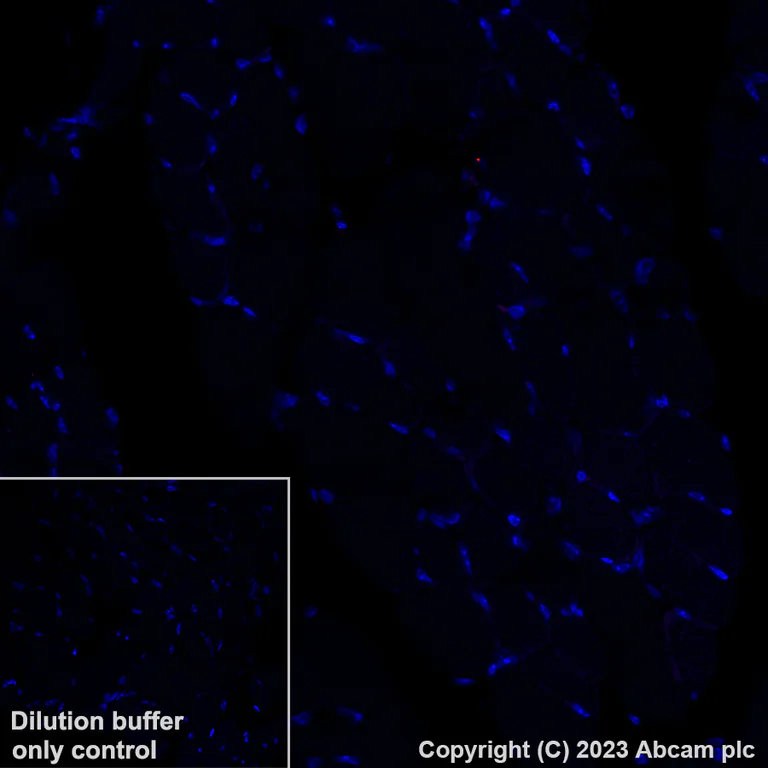 Immunohistochemistry (Formalin/PFA-fixed paraffin-embedded sections) - Alexa Fluor® 555 Anti-Brachyury / Bry antibody [EPR18113] (AB314675)
