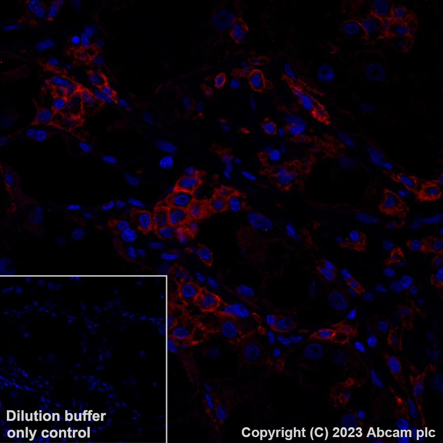 Immunohistochemistry (Formalin/PFA-fixed paraffin-embedded sections) - Alexa Fluor® 555 Anti-C5a-R antibody [EPR23278-117] (AB314337), expandable thumbnail