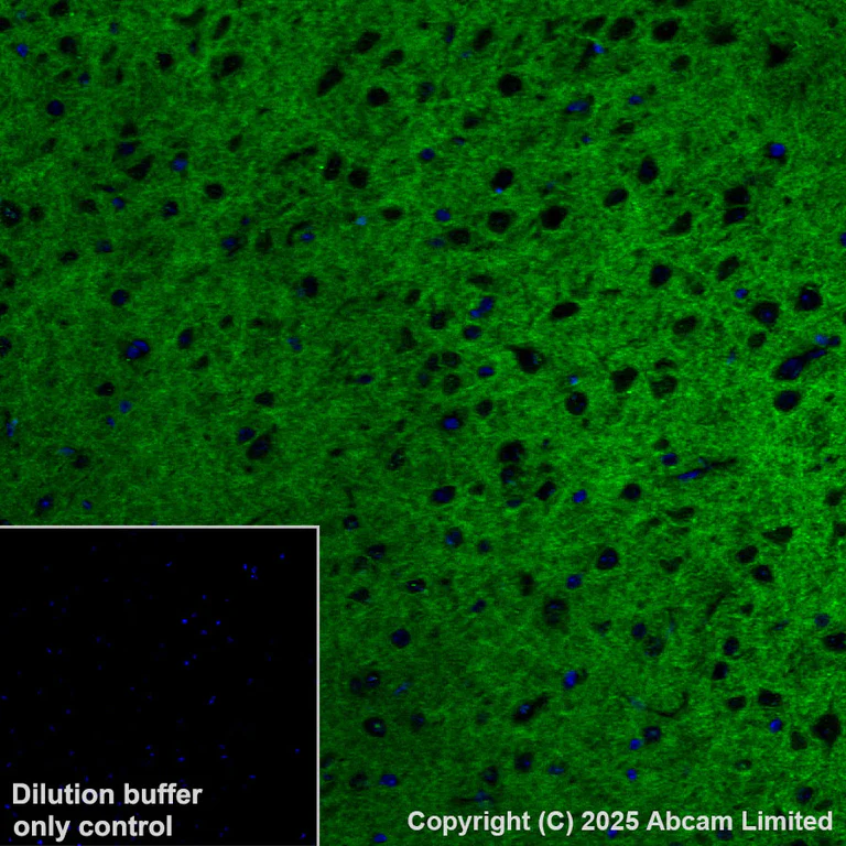Immunohistochemistry (Formalin/PFA-fixed paraffin-embedded sections) - Alexa Fluor® 555 Anti-Calcium Pump PMCA2 ATPase antibody [EPR28923-56] (AB324300)