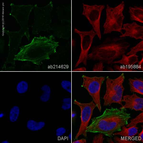 Immunocytochemistry/ Immunofluorescence - Alexa Fluor® 555 Anti-Caldesmon/CDM antibody [E89] (AB214629), expandable thumbnail