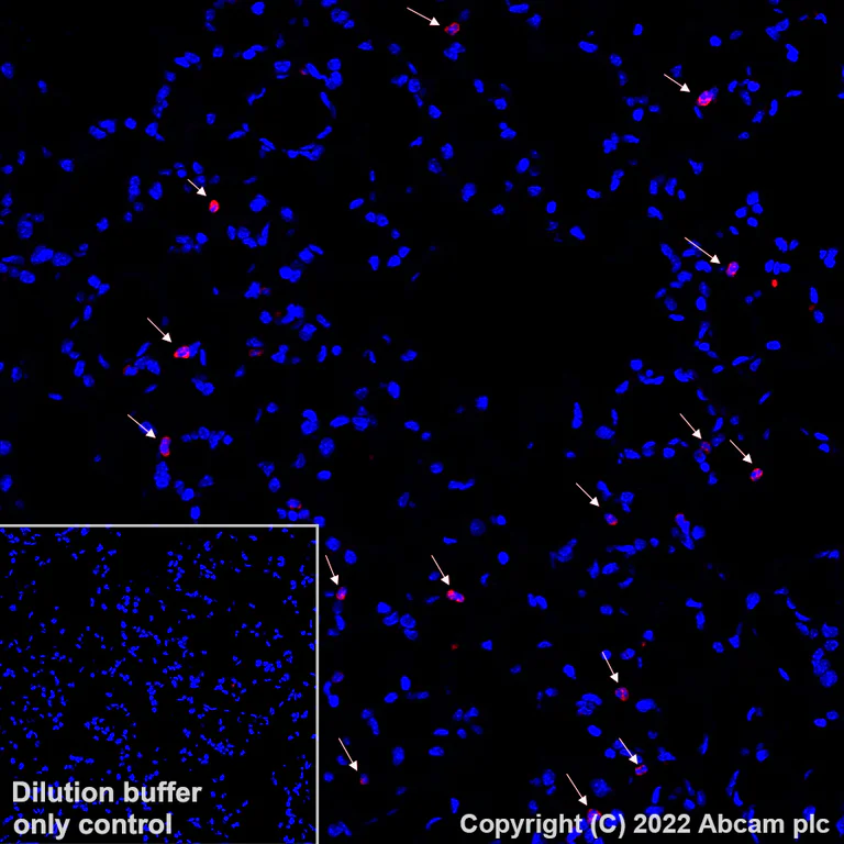 Immunohistochemistry (Formalin/PFA-fixed paraffin-embedded sections) - Alexa Fluor® 555 Anti-CD11b antibody [EPR1344] (AB307391)
