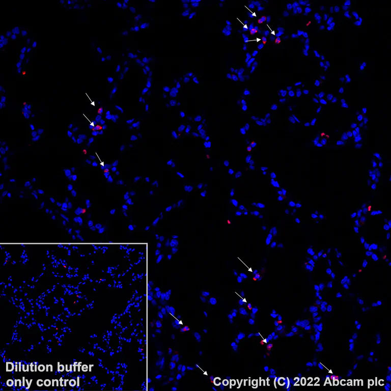 Immunohistochemistry (Formalin/PFA-fixed paraffin-embedded sections) - Alexa Fluor® 555 Anti-CD11b antibody [EPR1344] (AB307391)