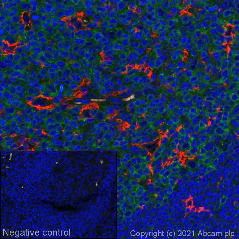 Immunohistochemistry (Formalin/PFA-fixed paraffin-embedded sections) - Alexa Fluor® 555 Anti-CD11c antibody [EP1347Y] (AB279329)