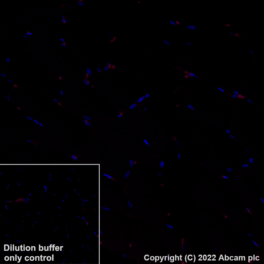 Immunohistochemistry (Formalin/PFA-fixed paraffin-embedded sections) - Alexa Fluor® 555 Anti-CD146 antibody [EPR3208] (AB307390), expandable thumbnail