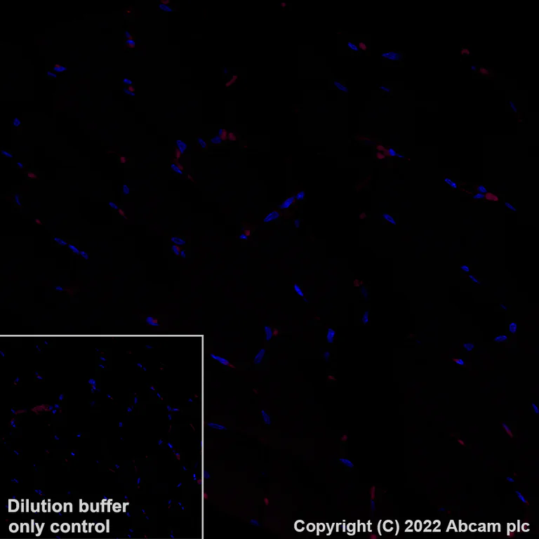 Immunohistochemistry (Formalin/PFA-fixed paraffin-embedded sections) - Alexa Fluor® 555 Anti-CD146 antibody [EPR3208] (AB307390)