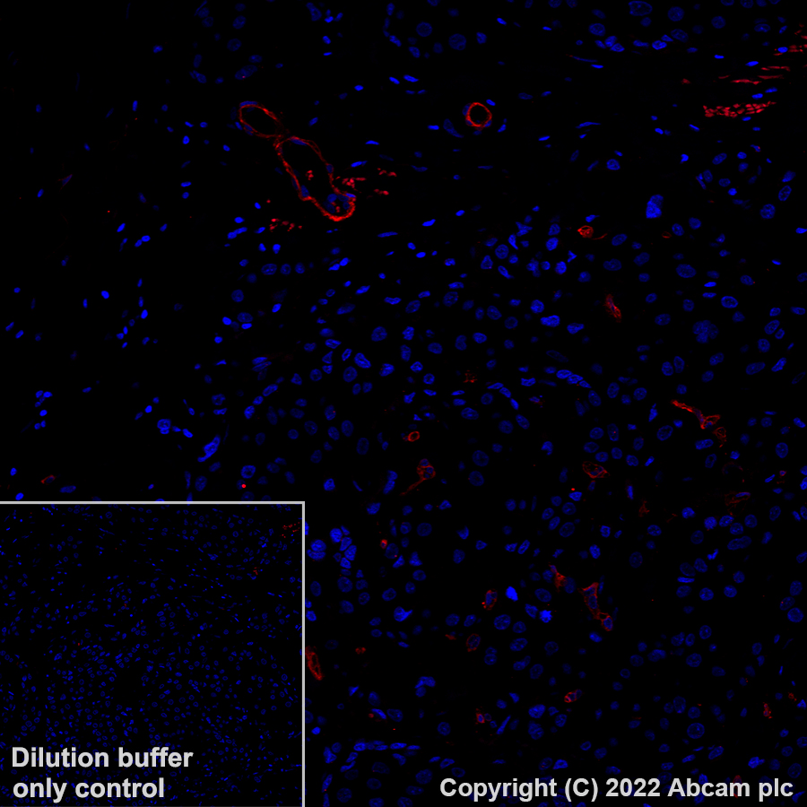 Immunohistochemistry (Formalin/PFA-fixed paraffin-embedded sections) - Alexa Fluor® 555 Anti-CD146 antibody [EPR3208] (AB307390), expandable thumbnail
