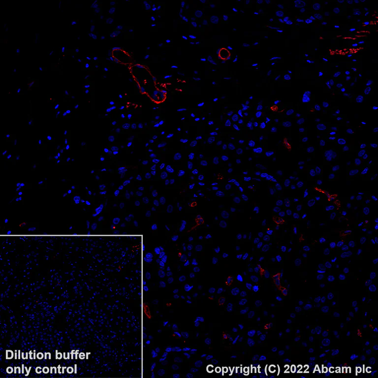 Immunohistochemistry (Formalin/PFA-fixed paraffin-embedded sections) - Alexa Fluor® 555 Anti-CD146 antibody [EPR3208] (AB307390)