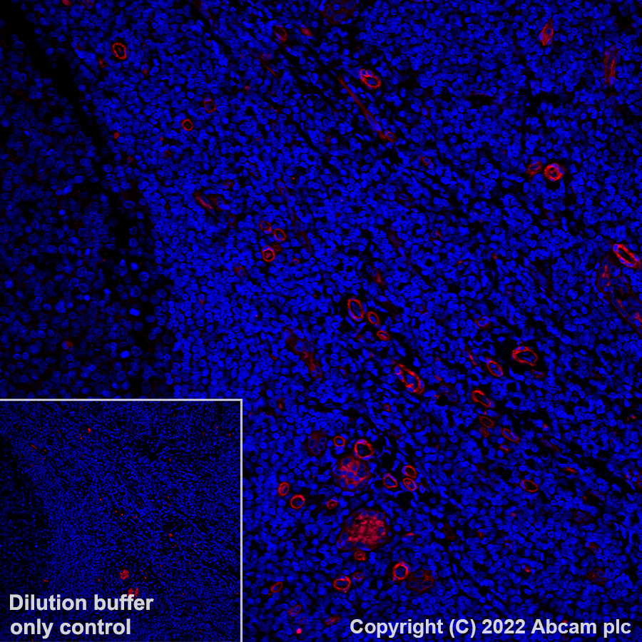 Immunohistochemistry (Formalin/PFA-fixed paraffin-embedded sections) - Alexa Fluor® 555 Anti-CD146 antibody [EPR3208] (AB307390), expandable thumbnail