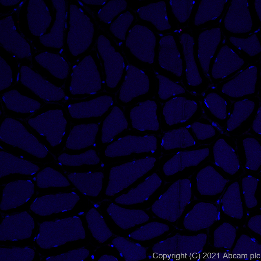 Immunohistochemistry (Formalin/PFA-fixed paraffin-embedded sections) - Alexa Fluor® 555 Anti-CD15 antibody [SP159] (AB281744), expandable thumbnail