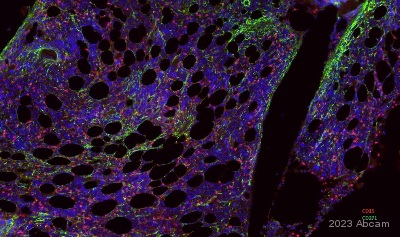 Immunohistochemistry (Formalin/PFA-fixed paraffin-embedded sections) - Alexa Fluor® 555 Anti-CD15 antibody [SP159] (AB281744), expandable thumbnail