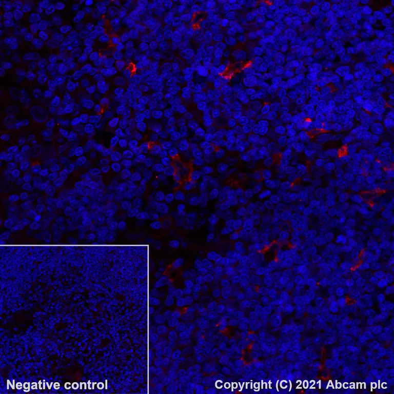 Immunohistochemistry (Formalin/PFA-fixed paraffin-embedded sections) - Alexa Fluor® 555 Anti-CD16 antibody [EPR16784] (AB281764)