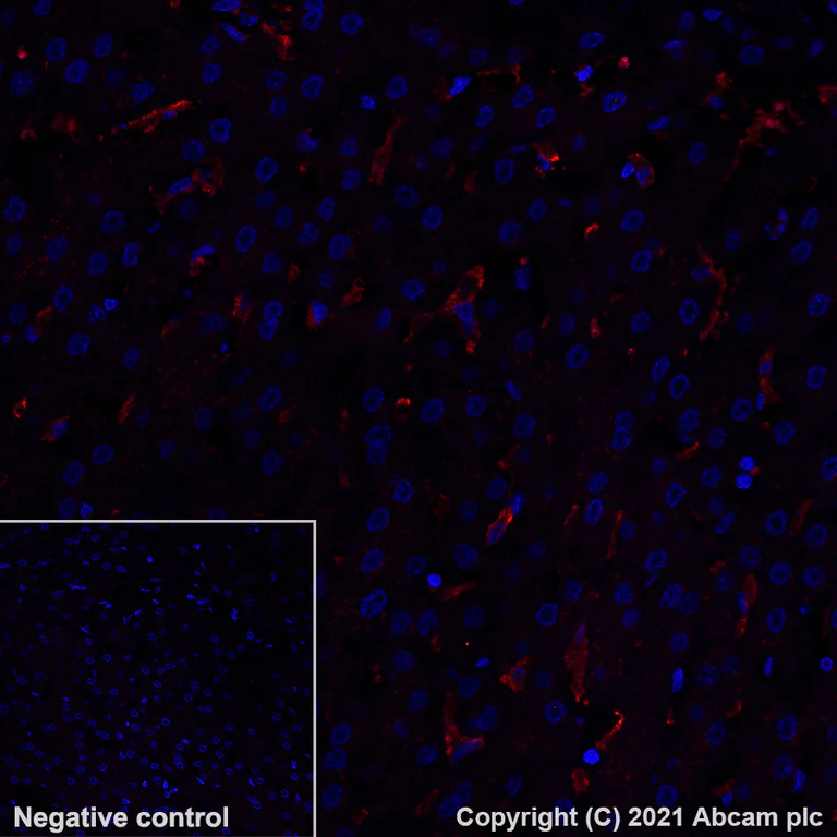 Immunohistochemistry (Formalin/PFA-fixed paraffin-embedded sections) - Alexa Fluor® 555 Anti-CD16 antibody [EPR16784] (AB281764)