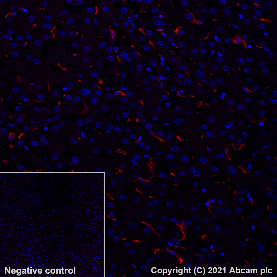 Immunohistochemistry (Formalin/PFA-fixed paraffin-embedded sections) - Alexa Fluor® 555 Anti-CD163 antibody [EPR19518] (AB281746)