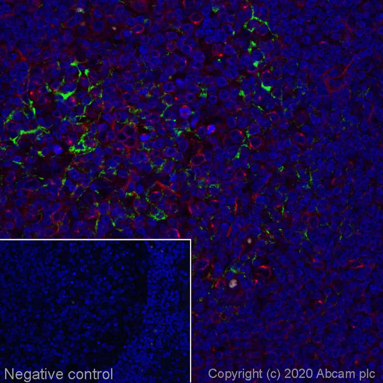 Immunohistochemistry (Formalin/PFA-fixed paraffin-embedded sections) - Alexa Fluor® 555 Anti-CD19 antibody [EPR5906] (AB274888)