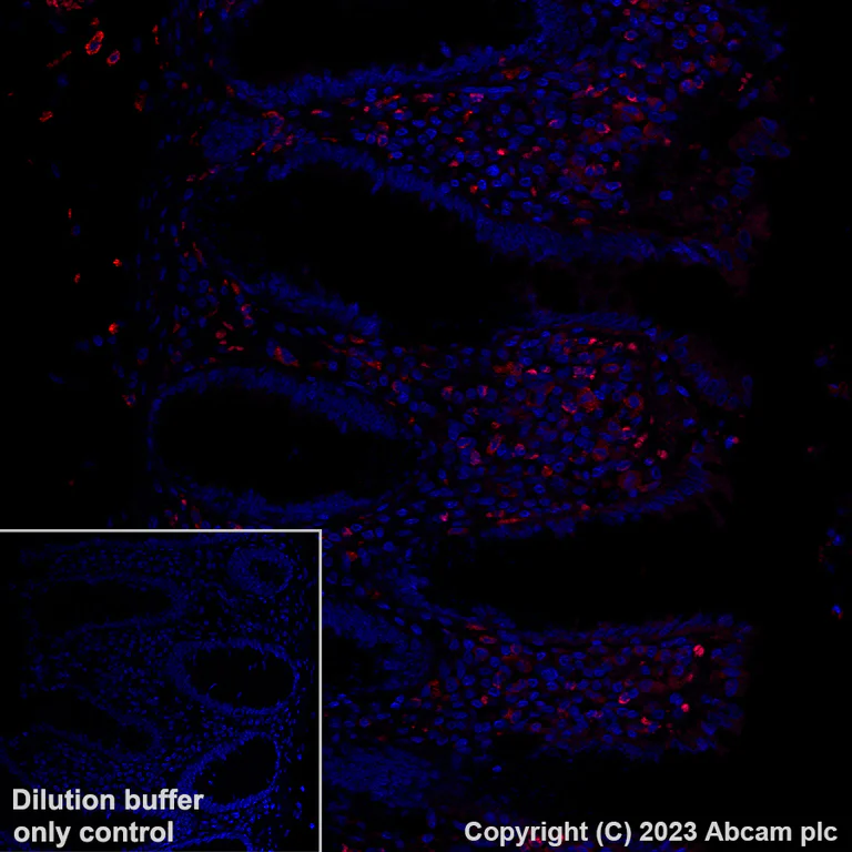 Immunohistochemistry (Formalin/PFA-fixed paraffin-embedded sections) - Alexa Fluor® 555 Anti-CD206 antibody [EPR22489-7] (AB313731)