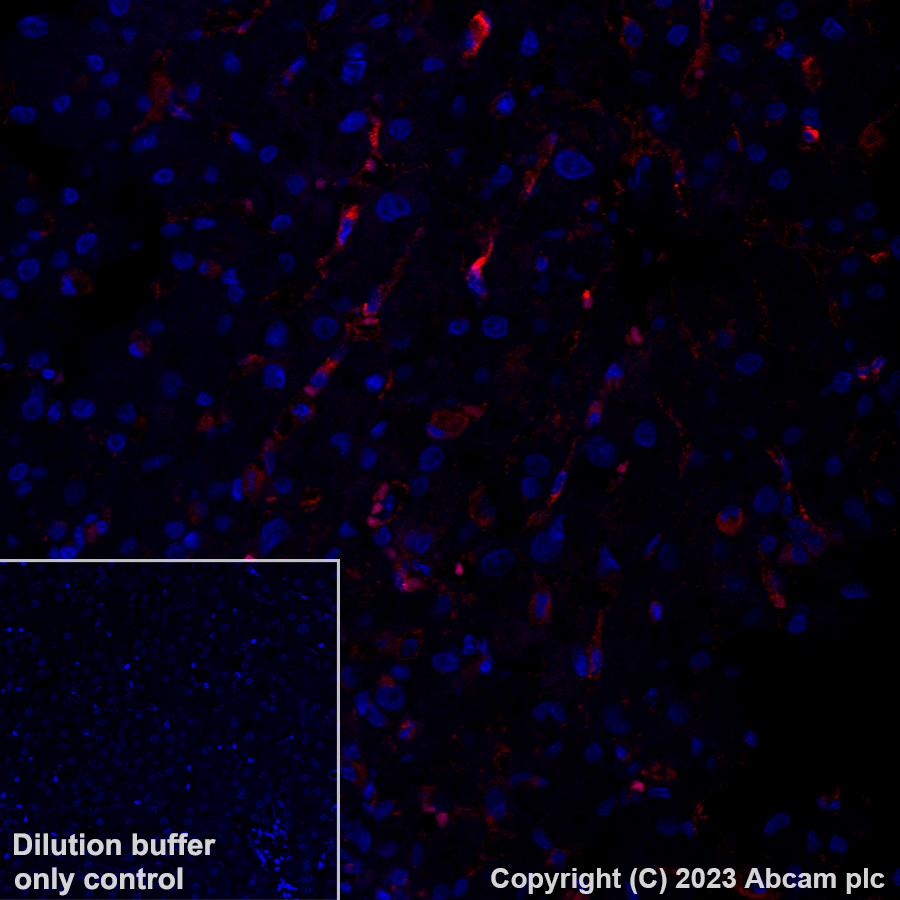 Immunohistochemistry (Formalin/PFA-fixed paraffin-embedded sections) - Alexa Fluor® 555 Anti-CD206 antibody [EPR22489-7] (AB313731)