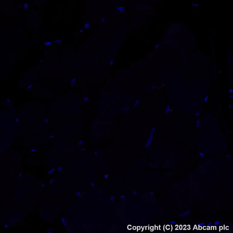 Immunohistochemistry (Formalin/PFA-fixed paraffin-embedded sections) - Alexa Fluor® 555 Anti-CD206 antibody [EPR22489-7] (AB313731)