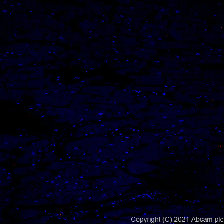 Immunohistochemistry (Formalin/PFA-fixed paraffin-embedded sections) - Alexa Fluor® 555 Anti-CD21 antibody [EP3093] (AB282007)