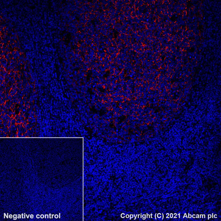 Immunohistochemistry (Formalin/PFA-fixed paraffin-embedded sections) - Alexa Fluor® 555 Anti-CD21 antibody [EP3093] (AB282007)