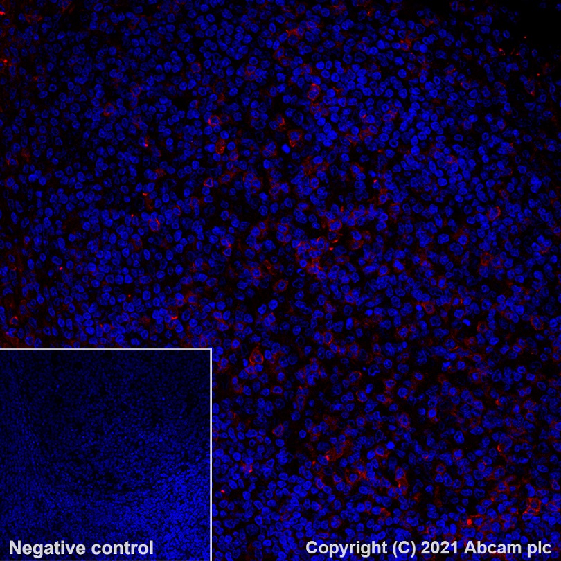 Immunohistochemistry (Formalin/PFA-fixed paraffin-embedded sections) - Alexa Fluor® 555 Anti-CD27 antibody [EPR8569] (AB282112), expandable thumbnail