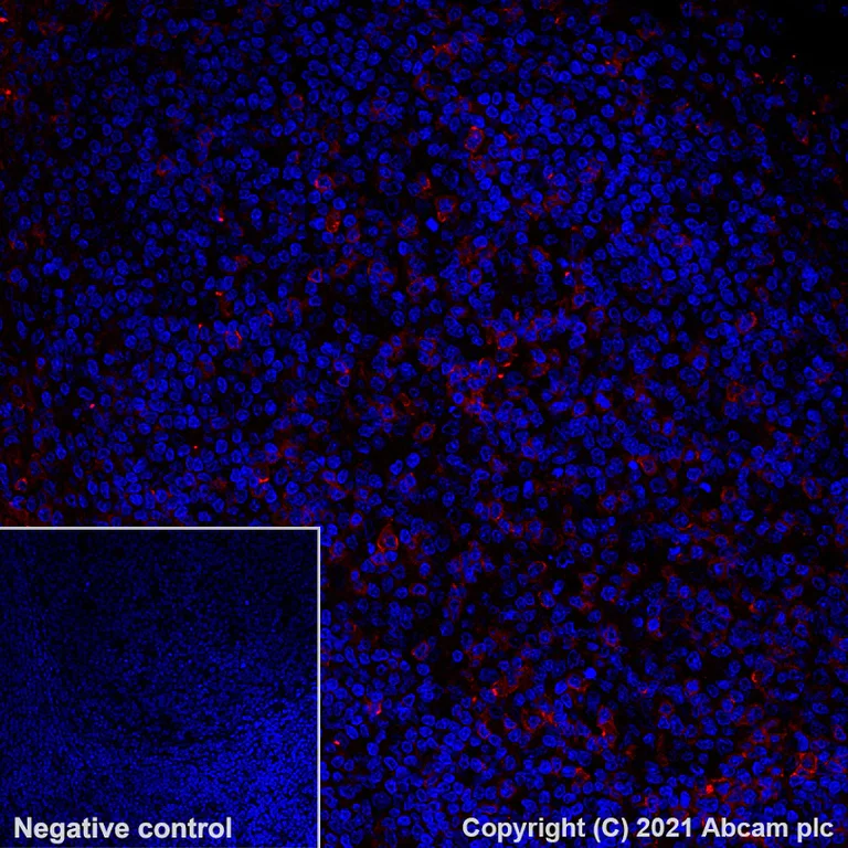 Immunohistochemistry (Formalin/PFA-fixed paraffin-embedded sections) - Alexa Fluor® 555 Anti-CD27 antibody [EPR8569] (AB282112)