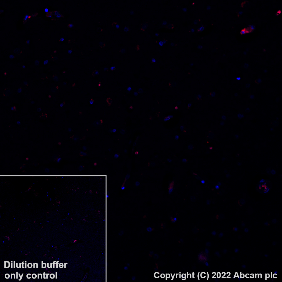 Immunohistochemistry (Formalin/PFA-fixed paraffin-embedded sections) - Alexa Fluor® 555 Anti-CD3 antibody [SP162] (AB307335), expandable thumbnail