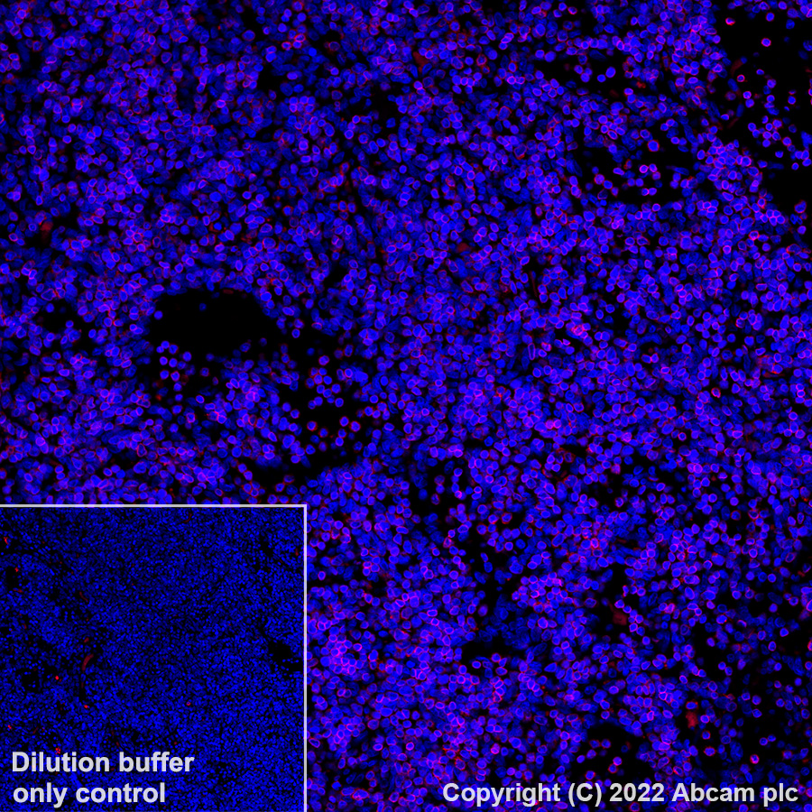 Immunohistochemistry (Formalin/PFA-fixed paraffin-embedded sections) - Alexa Fluor® 555 Anti-CD3 antibody [SP162] (AB307335), expandable thumbnail