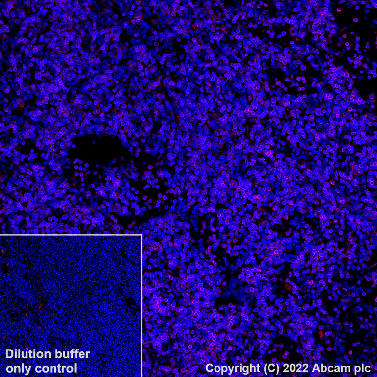 Immunohistochemistry (Formalin/PFA-fixed paraffin-embedded sections) - Alexa Fluor® 555 Anti-CD3 antibody [SP162] (AB307335)