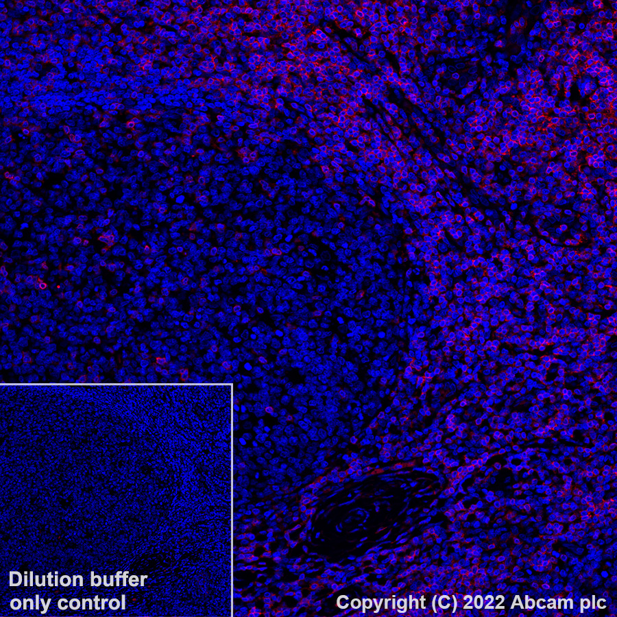 Immunohistochemistry (Formalin/PFA-fixed paraffin-embedded sections) - Alexa Fluor® 555 Anti-CD3 antibody [SP162] (AB307335), expandable thumbnail