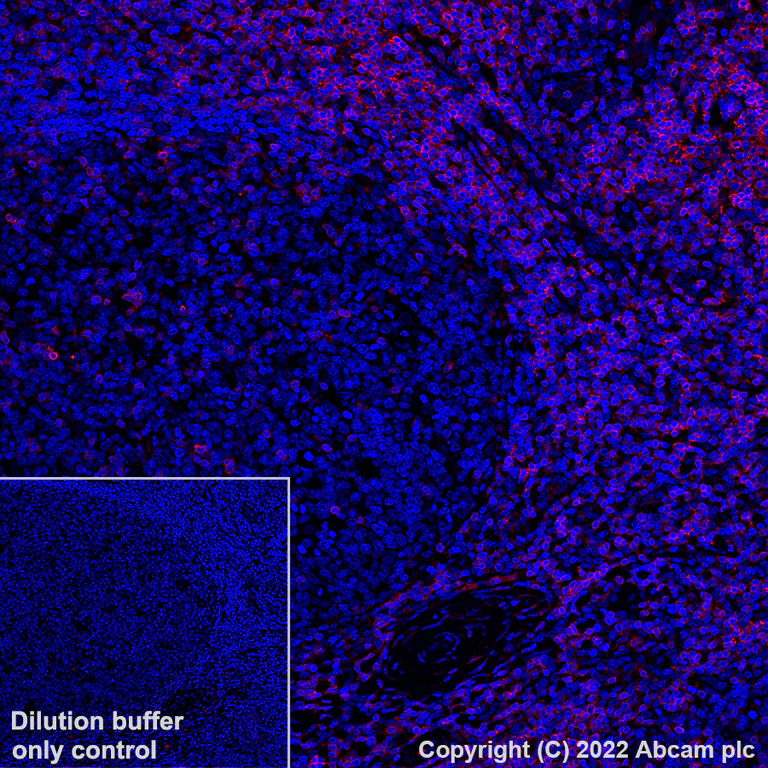 Immunohistochemistry (Formalin/PFA-fixed paraffin-embedded sections) - Alexa Fluor® 555 Anti-CD3 antibody [SP162] (AB307335)