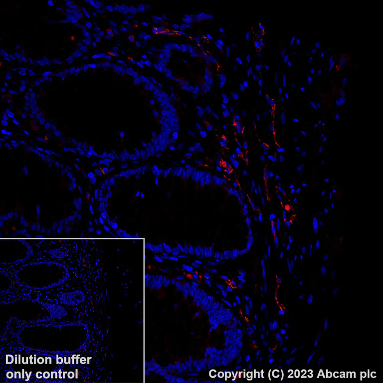 Immunohistochemistry (Formalin/PFA-fixed paraffin-embedded sections) - Alexa Fluor® 555 Anti-CD31 antibody [EPR17259] (AB312892)