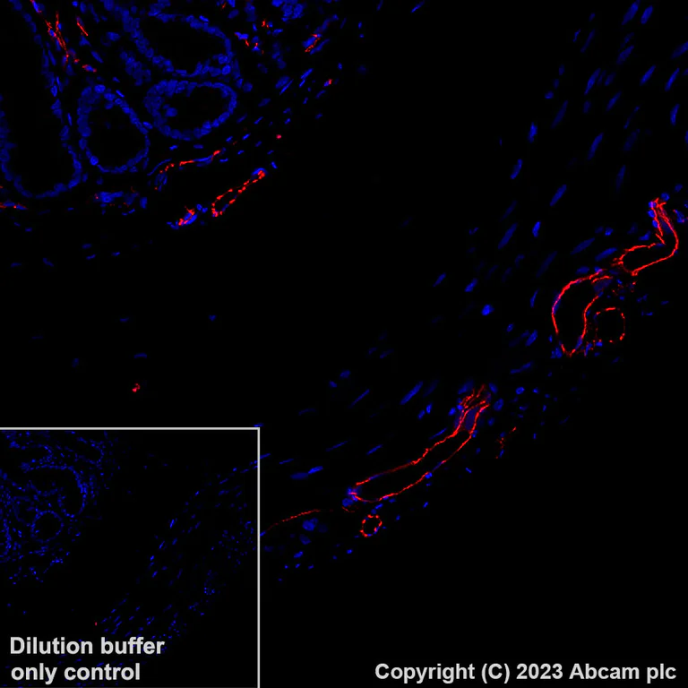 Immunohistochemistry (Formalin/PFA-fixed paraffin-embedded sections) - Alexa Fluor® 555 Anti-CD31 antibody [EPR17259] (AB312892)
