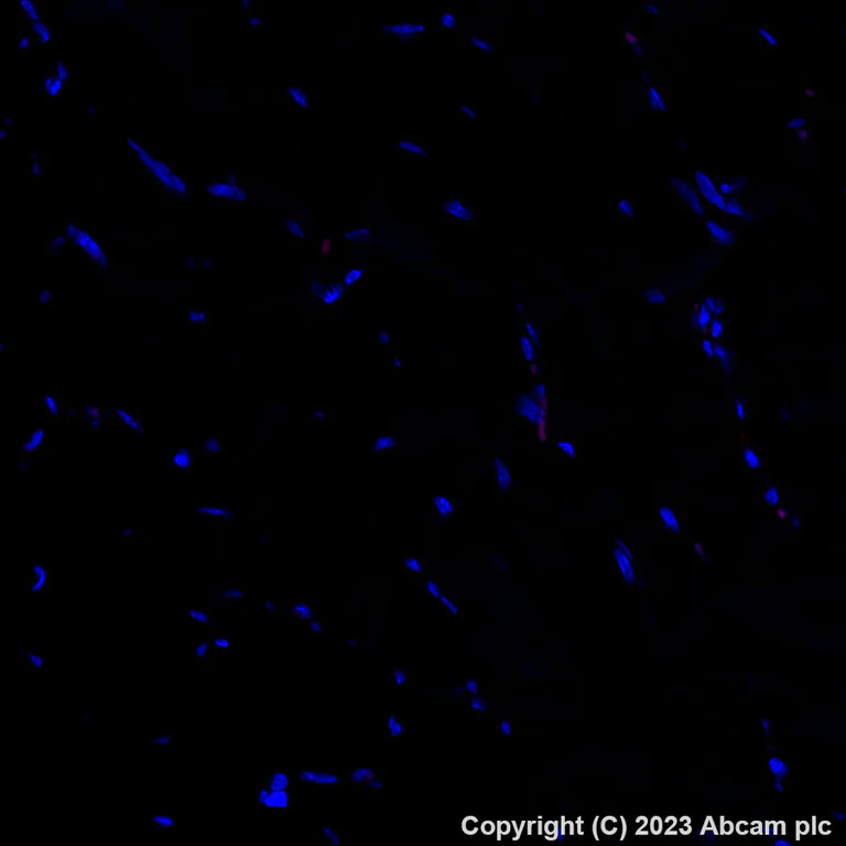Immunohistochemistry (Formalin/PFA-fixed paraffin-embedded sections) - Alexa Fluor® 555 Anti-CD31 antibody [EPR17259] (AB312892)