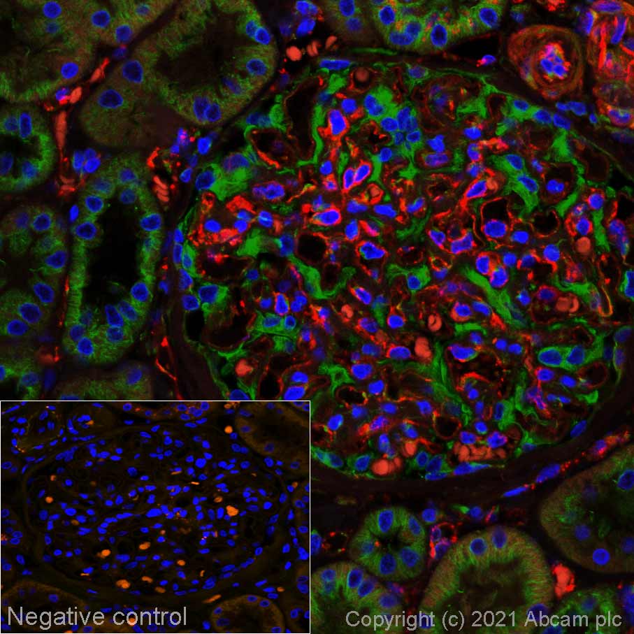 Immunohistochemistry (Formalin/PFA-fixed paraffin-embedded sections) - Alexa Fluor® 555 Anti-CD31 antibody [EPR3094] (AB279331), expandable thumbnail