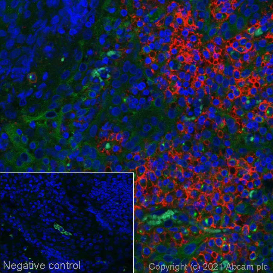 Immunohistochemistry (Formalin/PFA-fixed paraffin-embedded sections) - Alexa Fluor® 555 Anti-CD38 antibody [EPR4106] (AB279332), expandable thumbnail