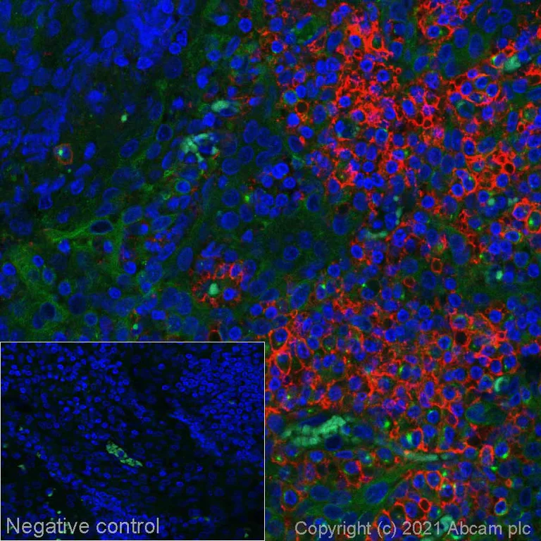 Immunohistochemistry (Formalin/PFA-fixed paraffin-embedded sections) - Alexa Fluor® 555 Anti-CD38 antibody [EPR4106] (AB279332)