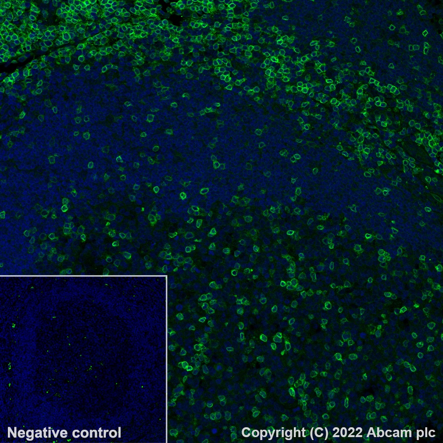 Immunohistochemistry (Formalin/PFA-fixed paraffin-embedded sections) - Alexa Fluor® 555 Anti-CD3D antibody [EP4426] (AB208514), expandable thumbnail