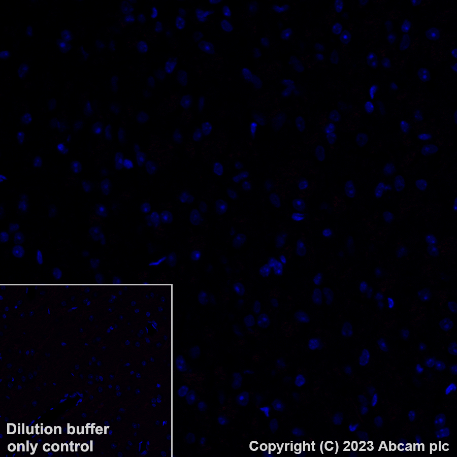 Immunohistochemistry (Formalin/PFA-fixed paraffin-embedded sections) - Alexa Fluor® 555 Anti-CD4 antibody [EPR19514] (AB313727), expandable thumbnail