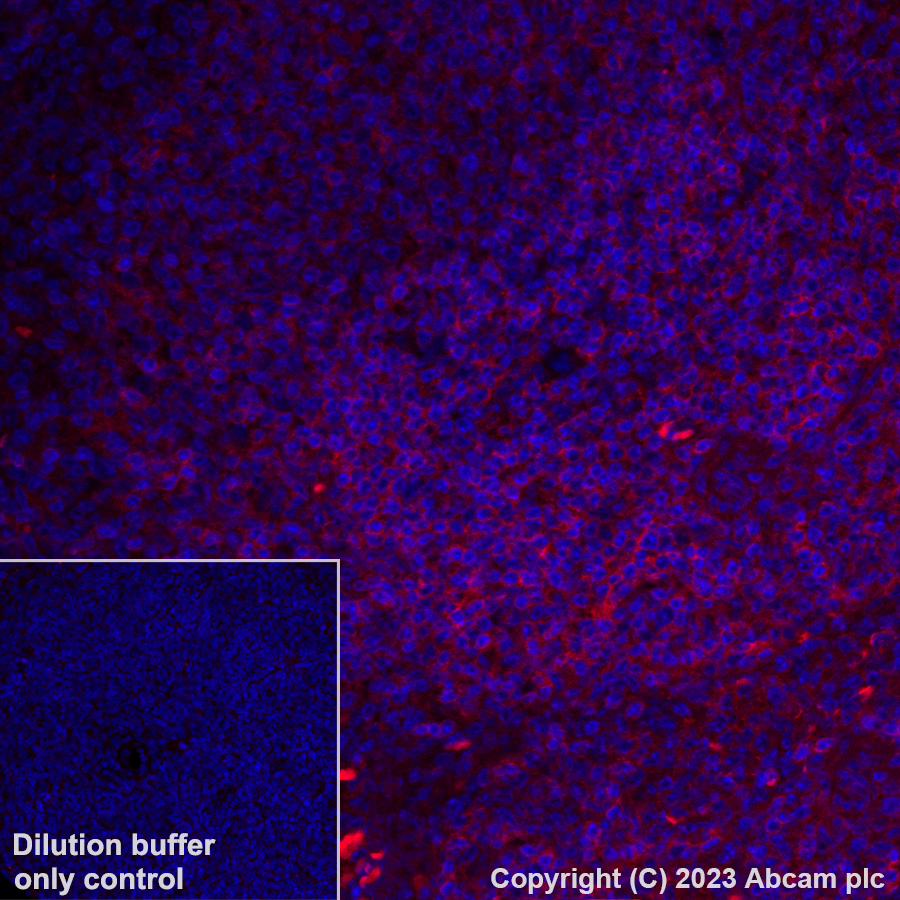 Immunohistochemistry (Formalin/PFA-fixed paraffin-embedded sections) - Alexa Fluor® 555 Anti-CD4 antibody [EPR19514] (AB313727), expandable thumbnail